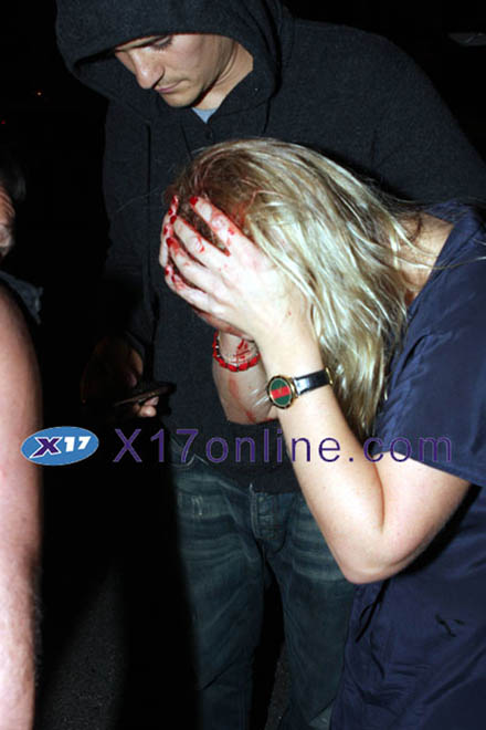 Orlando Bloom: car crash victim