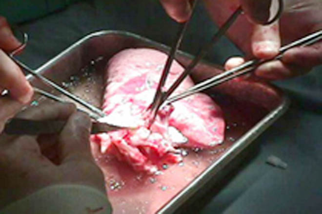 Parents of dead child give his organs to other patients