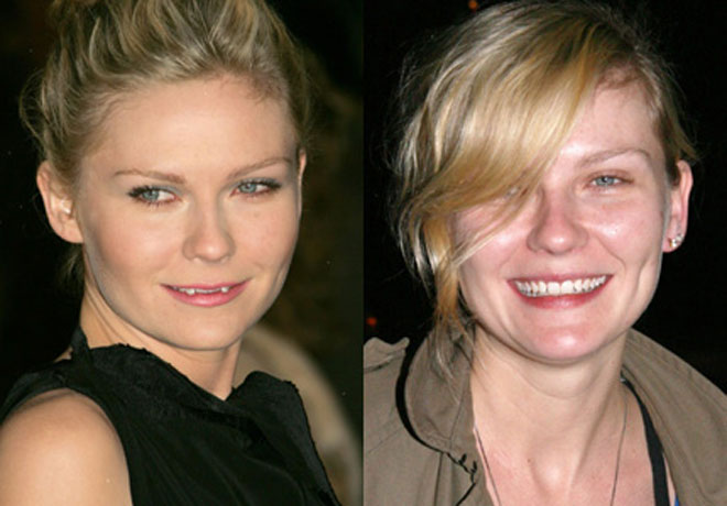 Kirsten Dunst's New Teeth?