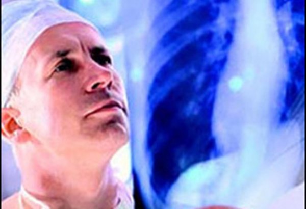 India plans to eradicate Tuberculosis by 2025