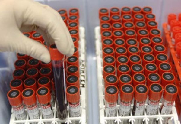 Tajikistan reports growth in pharmaceutical production in early 2026