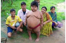 5-летняя индийская девочка весит 76 килограммов (фотосессия)