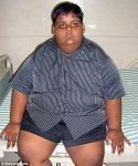 10-летнему мальчику сделали операцию по уменьшению желудка (фотосессия)