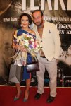 Кямран Агабалаев сделает пересадку волос для нового фильма  (ФОТО)