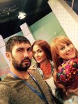 Как модель Кенуль Азизова стала жертвой "индустрии красоты" (ФОТО)