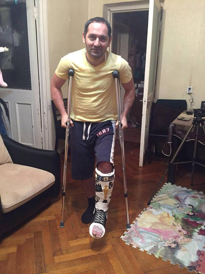 Нога в гипсе Эльнура Керимова стала креативным произведением (ФОТО)