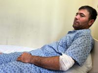 Azerbaijani civilian injured during Armenian terrorist attack, being treated in hospital (PHOTO)