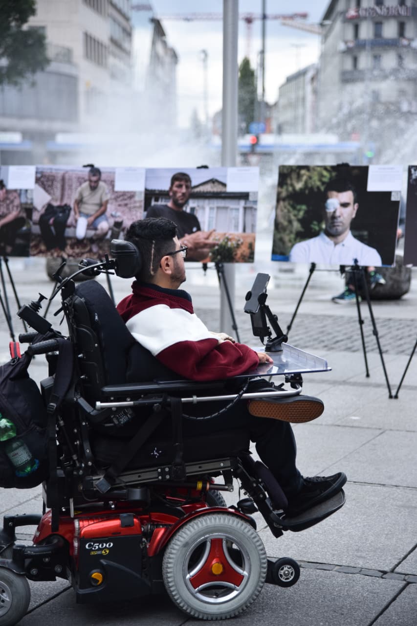 German Munich opens photo exhibition about mine victims in Azerbaijan (PHOTO)
